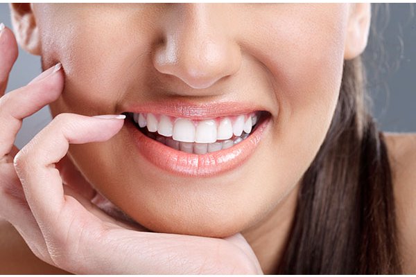 The Benefits of Dental Veneers for a Flawless Smile