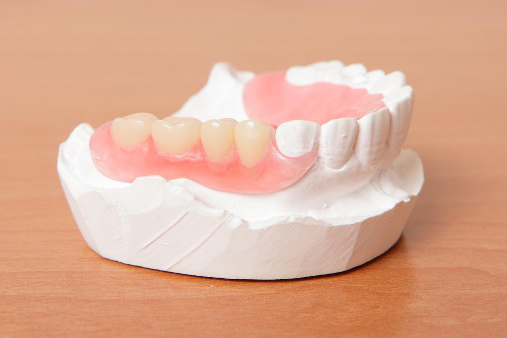 Things To Know About Dentures Before You Get Them