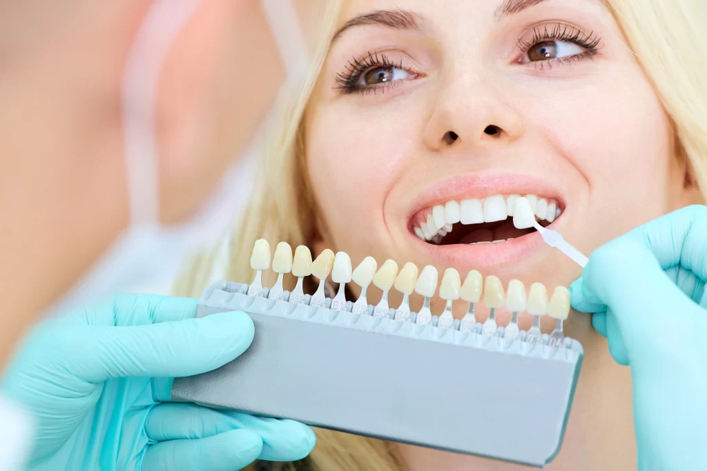 Teeth Whitening: A General Dentist’s Advice On Safe Practices