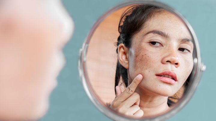 Effective Pigmentation Removal for Clearer Skin