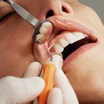Why Your General Dentist Recommends Fluoride Treatment