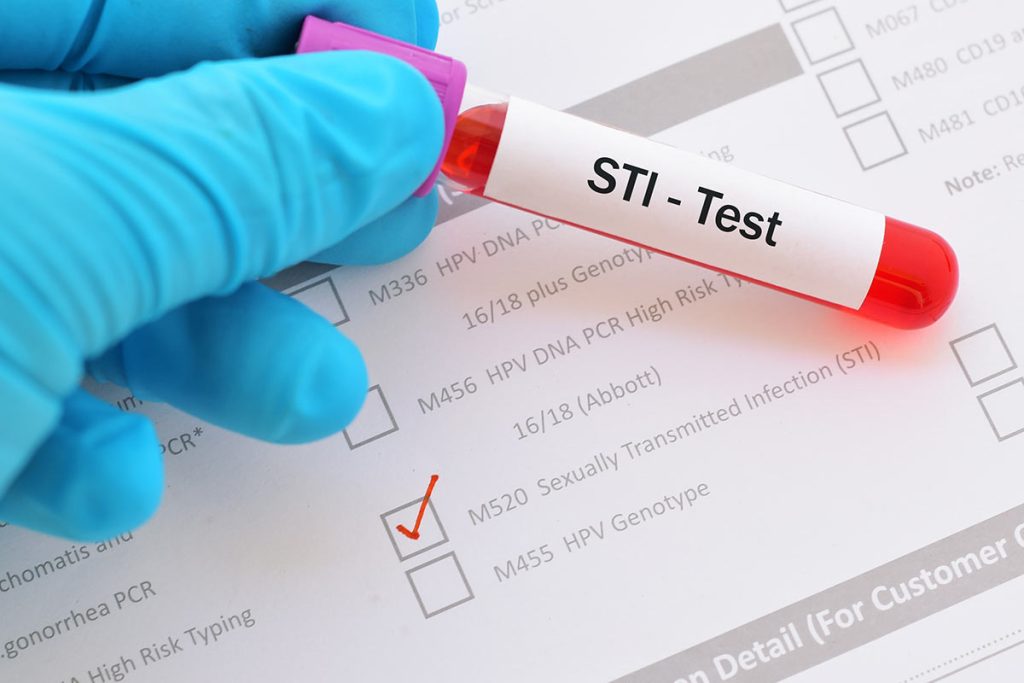 Peace of Mind Starts with a Reliable STD Test Option