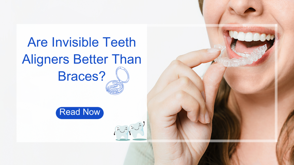 Are Invisible Teeth Aligners Better Than Braces?